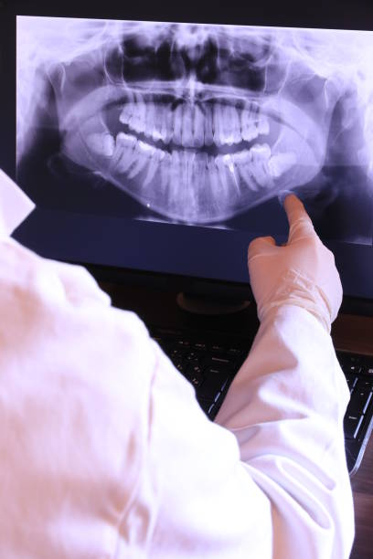 Best Root Canal Emergency Dentist  in Bovina, TX