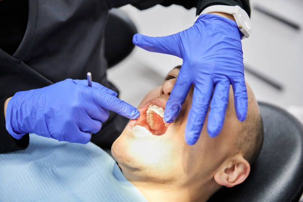 Best Emergency Gum Pain Relief  in Bovina, TX